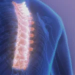 থোরাকোলাম্বার মেরুদণ্ডের অবক্ষয়জনিত ব্যাধি