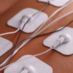 মেরুদণ্ডের বৈদ্যুতিক উদ্দীপনা