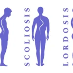 মেরুদণ্ডের বিকৃতি