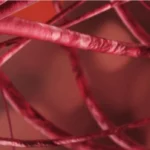 ধমনী বিকৃতি (AVM)