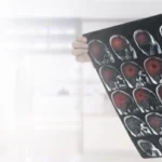 গুলির কারণে মাথায় আঘাত