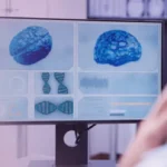 جراحات الأعصاب القحفية