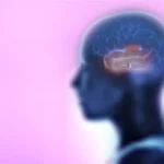 আনুষঙ্গিক টেম্পোরাল লোব মৃগীরোগ