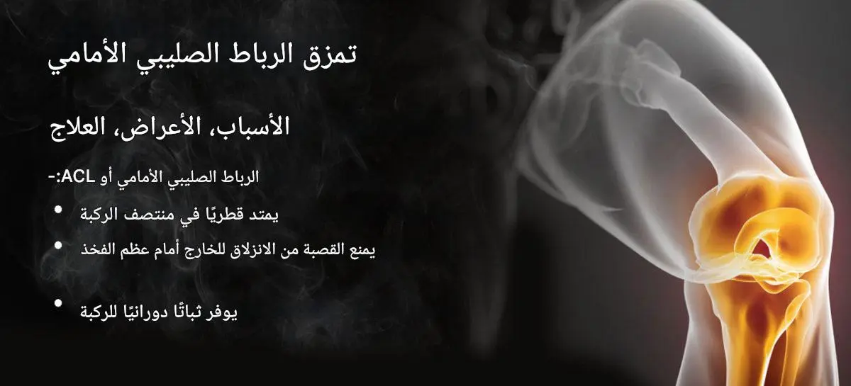 تمزق الرباط الصليبي الأمامي – الأسباب والأعراض والعلاج