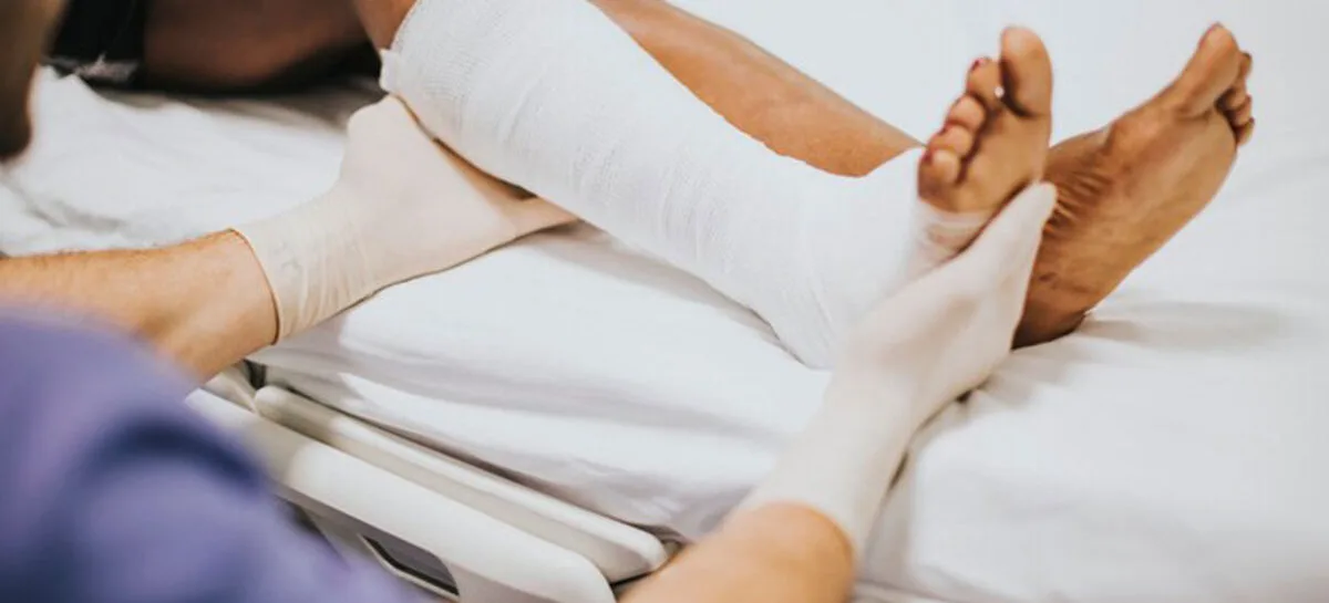 العناية بالجبس المكسور