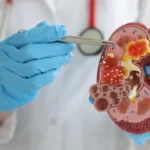 নেফ্রোলজি এবং ইউরোলজি